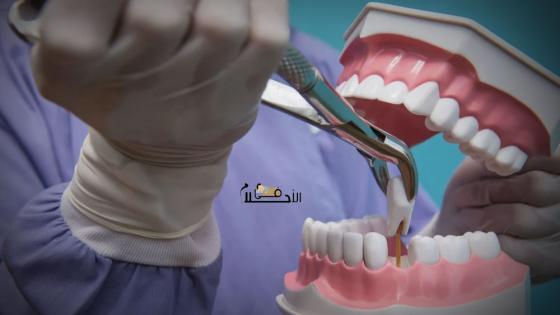تفسير حلم تصليح الأسنان عند الطبيب